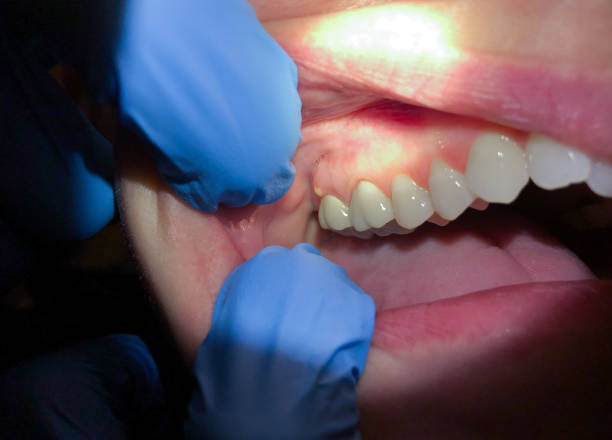 Best Emergency Dentist for Knocked-Out Tooth in Maugansville, MD
