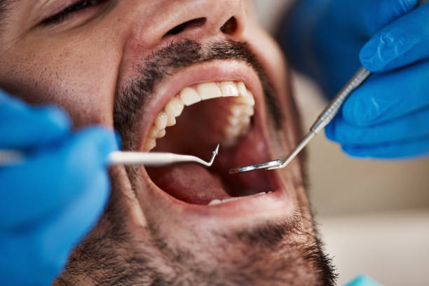 Best Emergency Dental Extractions in Maugansville, MD
